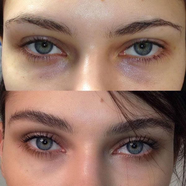 kırışıklık giderici, anti aging, selülit giderici, kırışıklıklara doğal çözüm, kırışıklıklara bitkisel çözüm, selülit, kırışıklığa iyi gelen kremler, üzüm çekirdeği yağı göz altına sürülürmü, kırışıklıklara kesin çözüm, göz çevresindeki morluklar, göz altındaki ince çizgiler, göz çevresindeki ince çizgiler için, kırışıklara kesin çözüm, yüz kırışıklıklarına ne iyi gelir, göz çevresini sıkılaştırmak için, anında yüz gerdiren kremler, lavieor serum, göz kazayağı, yüzdeki kırışıklıklara kesin çözüm