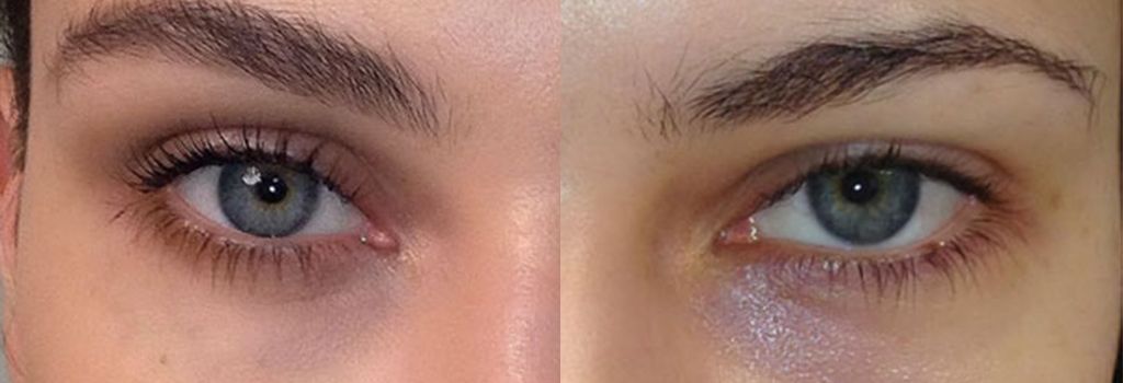 kırışıklık giderici, anti aging, selülit giderici, kırışıklıklara doğal çözüm, kırışıklıklara bitkisel çözüm, selülit, kırışıklığa iyi gelen kremler, üzüm çekirdeği yağı göz altına sürülürmü, kırışıklıklara kesin çözüm, göz çevresindeki morluklar, göz altındaki ince çizgiler, göz çevresindeki ince çizgiler için, kırışıklara kesin çözüm, yüz kırışıklıklarına ne iyi gelir, göz çevresini sıkılaştırmak için, anında yüz gerdiren kremler, lavieor serum, göz kazayağı, yüzdeki kırışıklıklara kesin çözüm