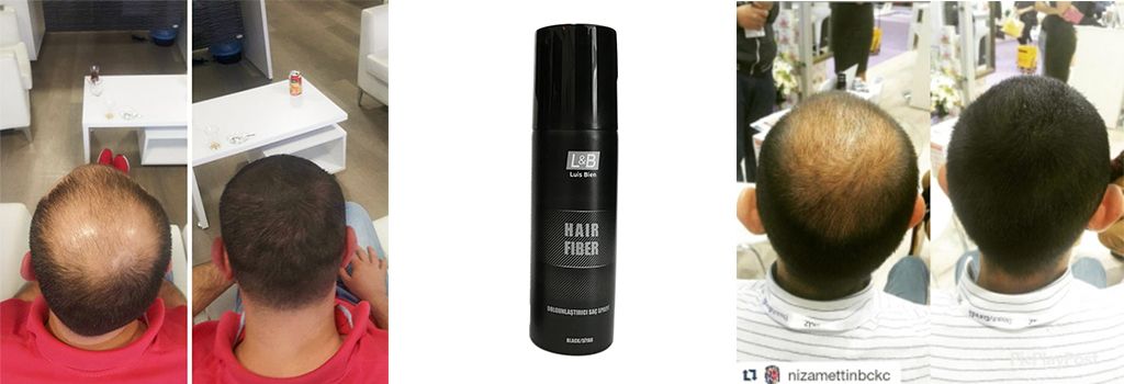 hair fiber spray, fiber hair, fiber hair spray, hair fiber toppik, hair fiber spray fiyat, hair fiber spray yorum, sevich hair fiber, hair fiber sprey, hair fiber yorum, hair fiber, toppik, hair toppik, toppik uygulama, toppik keratin uygulama
