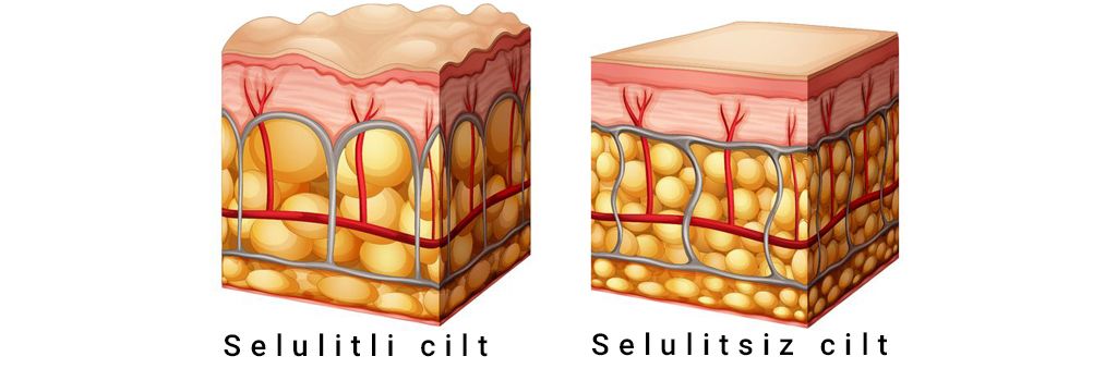 selülit, selülit yağı, selülit çayı, selülit ilacı, selülit diyeti, selülit jeli, anti selülit, selülit maskesi, selülit yok edici, selülit serumu, selülit için yağ, selülit sabunu, selülit tedavi yöntemleri, selülit aleti, selülit gidermek için, selülit kürü, selülit için, aloe vera selülit, selülit kesin çözüm, selülit yok etme